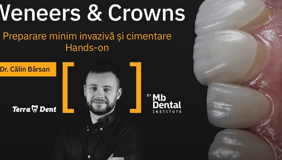 Veneers & Crowns – preparare minim invaziva si cimentare